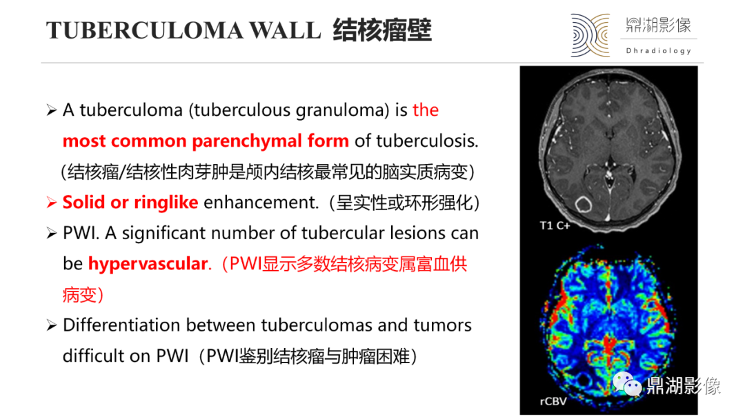影像PPT - 【PPT】脑内感染性环形强化病变病因诊断的MRI线索-22