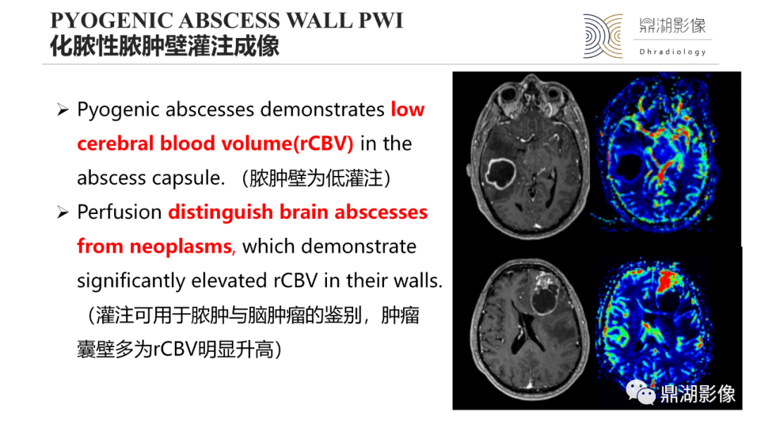 影像PPT - 【PPT】脑内感染性环形强化病变病因诊断的MRI线索-16
