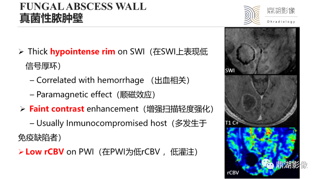 影像PPT - 【PPT】脑内感染性环形强化病变病因诊断的MRI线索-18
