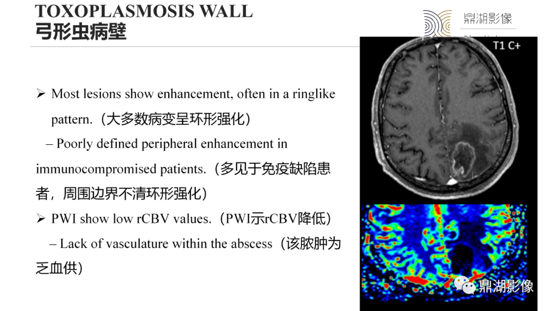 影像PPT - 【PPT】脑内感染性环形强化病变病因诊断的MRI线索-27