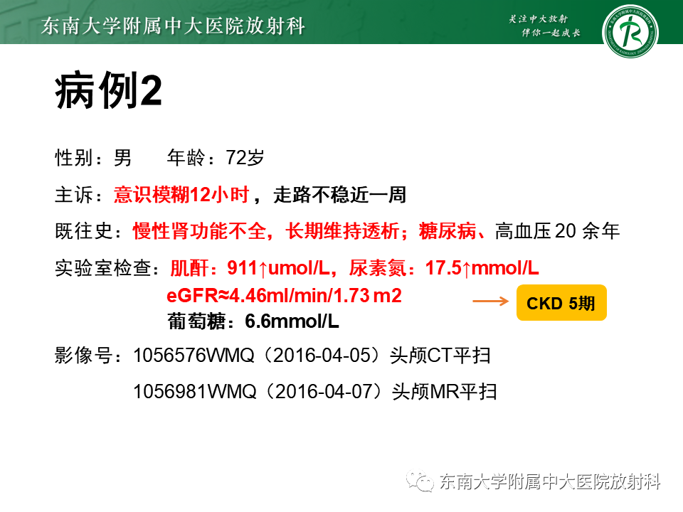 影像PPT - 【PPT】豆状核叉征(LFS)—透析性脑病-17 影像PPT - 【PPT】豆状核叉征(LFS)—透析性脑病-17