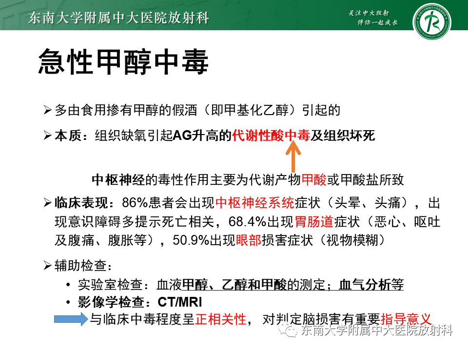 影像PPT - 【PPT】豆状核叉征(LFS)—透析性脑病-21 影像PPT - 【PPT】豆状核叉征(LFS)—透析性脑病-21