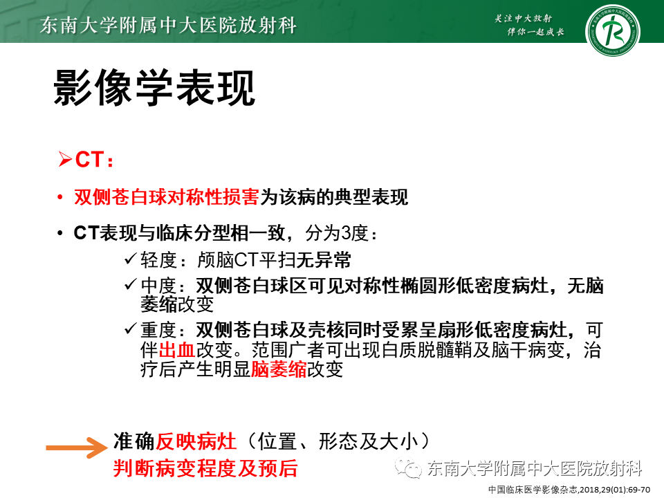 影像PPT - 【PPT】豆状核叉征(LFS)—透析性脑病-25 影像PPT - 【PPT】豆状核叉征(LFS)—透析性脑病-25