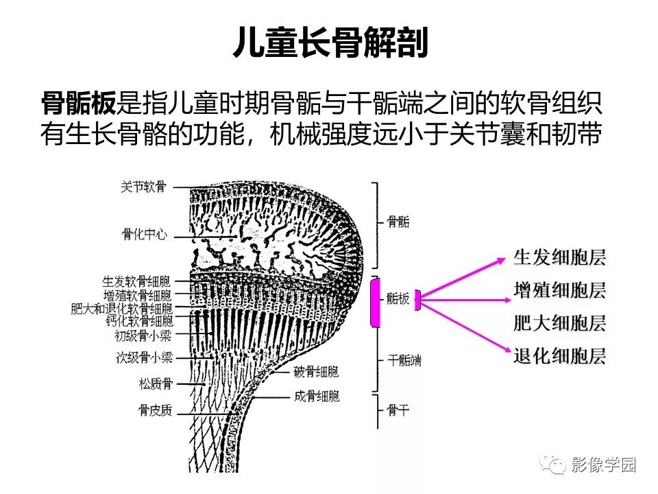影像PPT - 【PPT】儿童骨骺损伤影像诊断-3