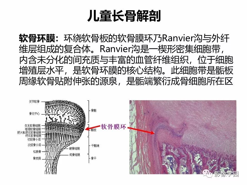 影像PPT - 【PPT】儿童骨骺损伤影像诊断-4