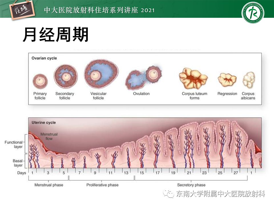 影像PPT - 【PPT】卵巢黄体及相关疾病诊断及鉴别-11