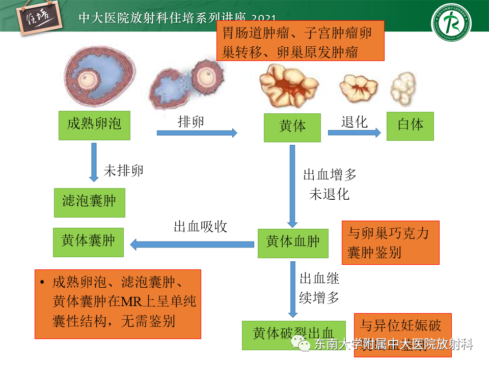 影像PPT - 【PPT】卵巢黄体及相关疾病诊断及鉴别-25
