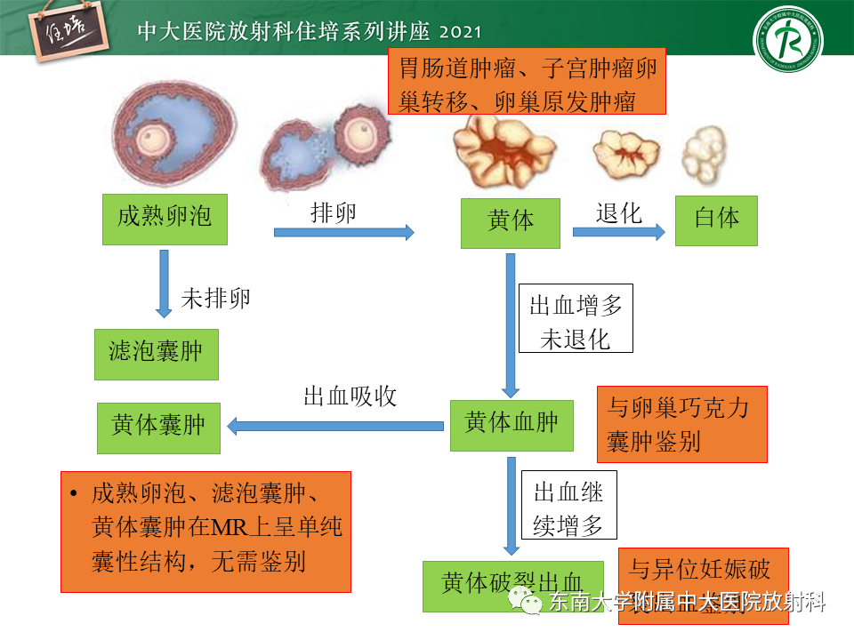 影像PPT - 【PPT】卵巢黄体及相关疾病诊断及鉴别-40