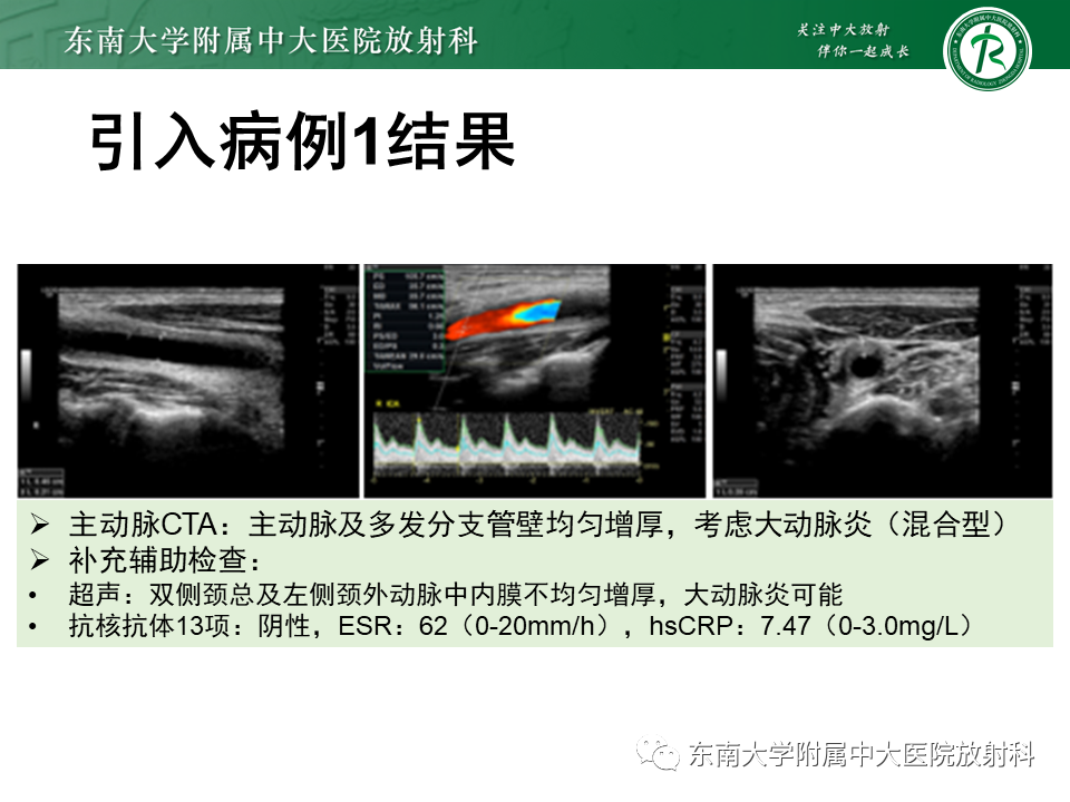 影像PPT - 【PPT】系统性血管炎-2