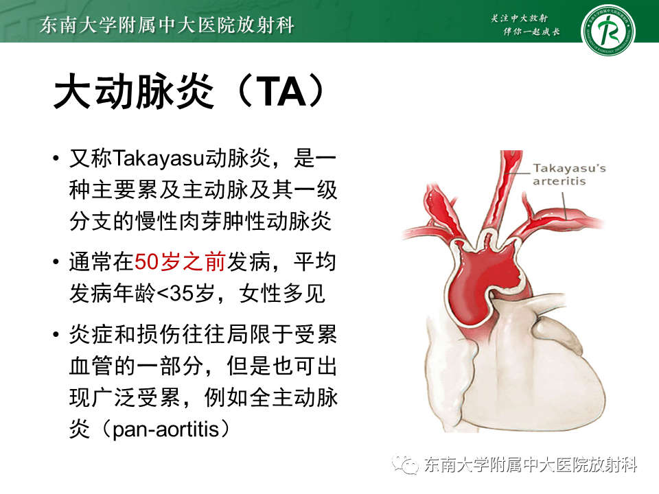 影像PPT - 【PPT】系统性血管炎-8