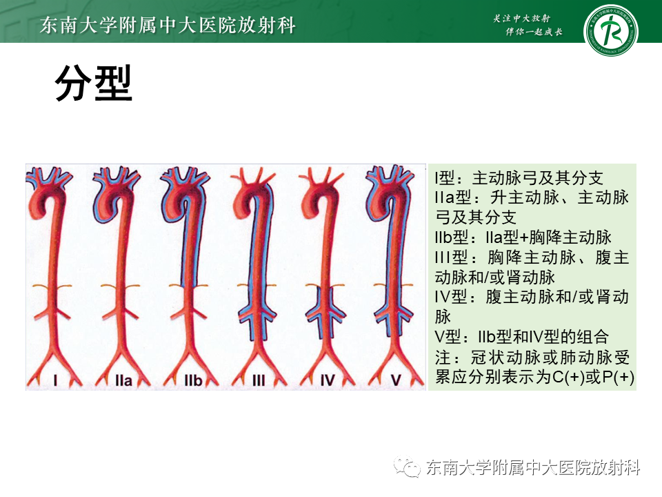影像PPT - 【PPT】系统性血管炎-10