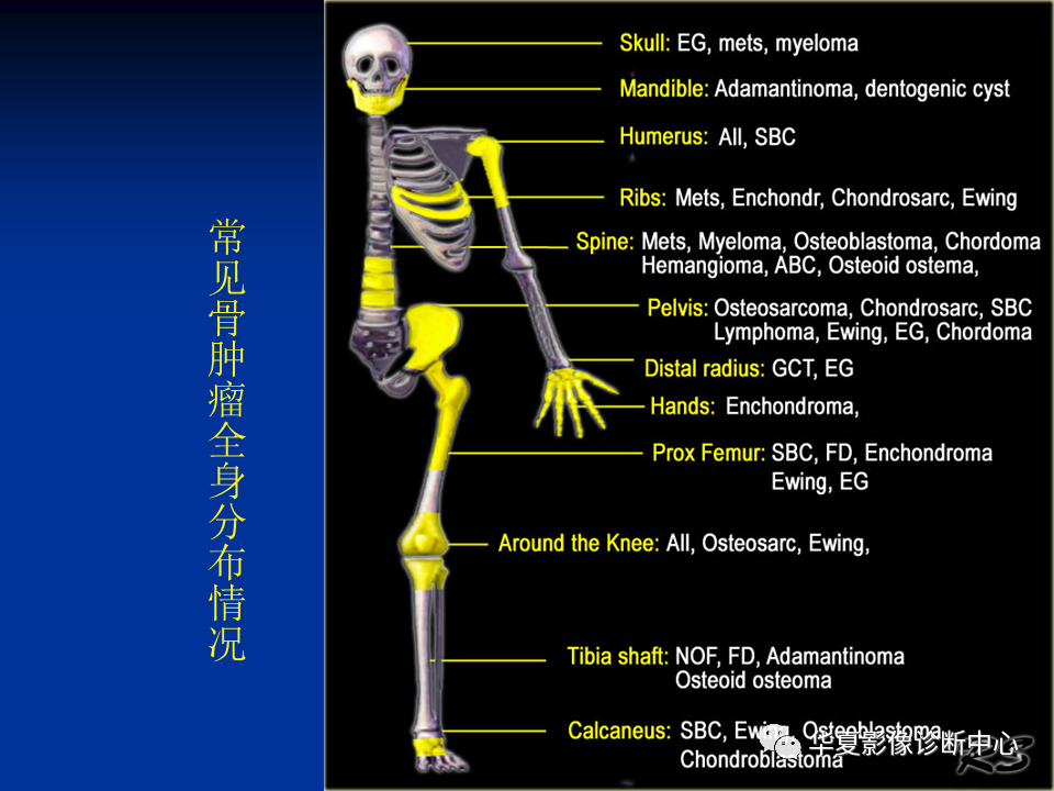 影像PPT - 【PPT】骨肿瘤影像诊断思路-33
