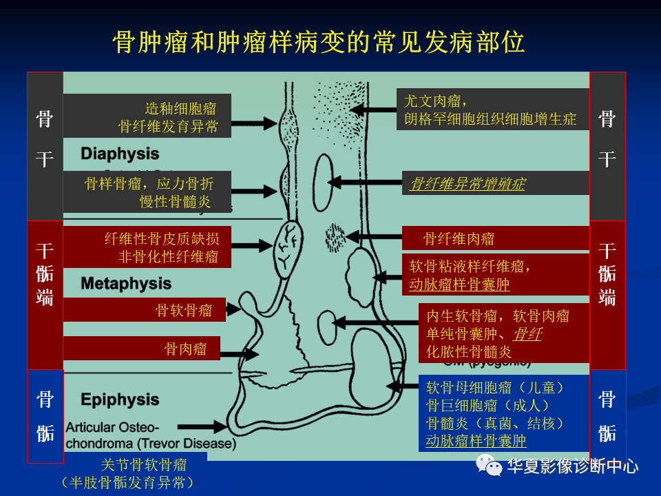 影像PPT - 【PPT】骨肿瘤影像诊断思路-36