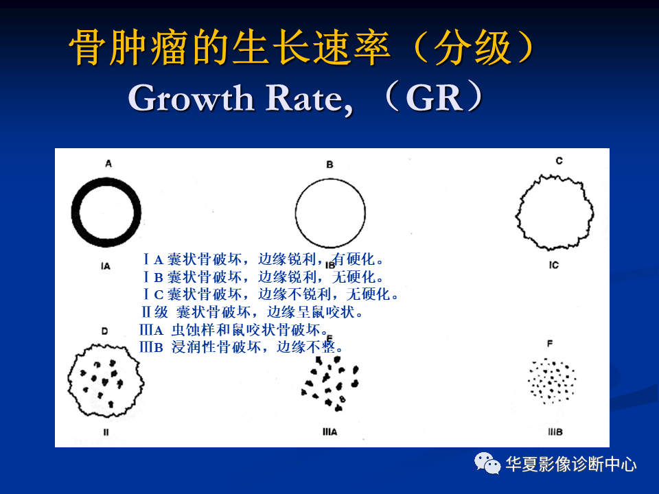 影像PPT - 【PPT】骨肿瘤影像诊断思路-48