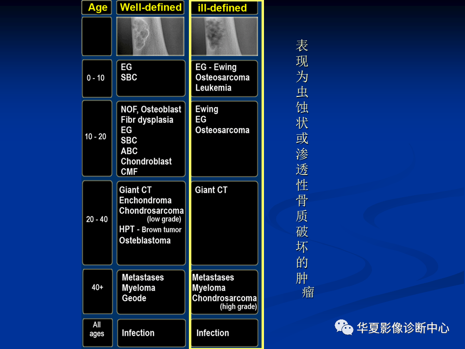 影像PPT - 【PPT】骨肿瘤影像诊断思路-60