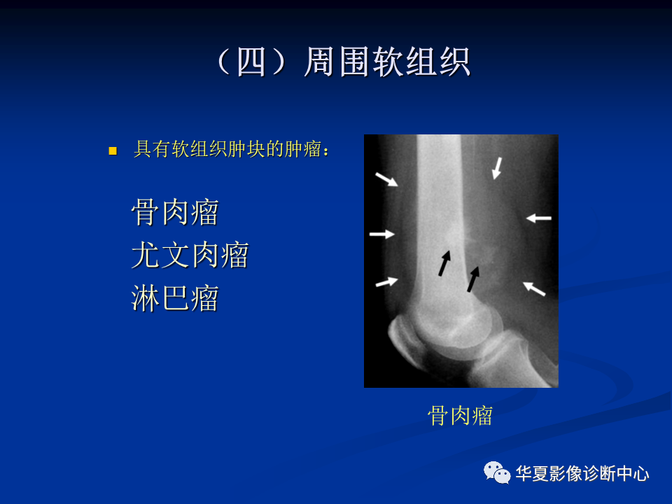 影像PPT - 【PPT】骨肿瘤影像诊断思路-77