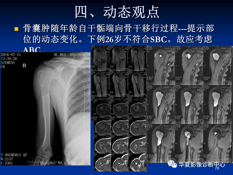 影像PPT - 【PPT】骨肿瘤影像诊断思路-78
