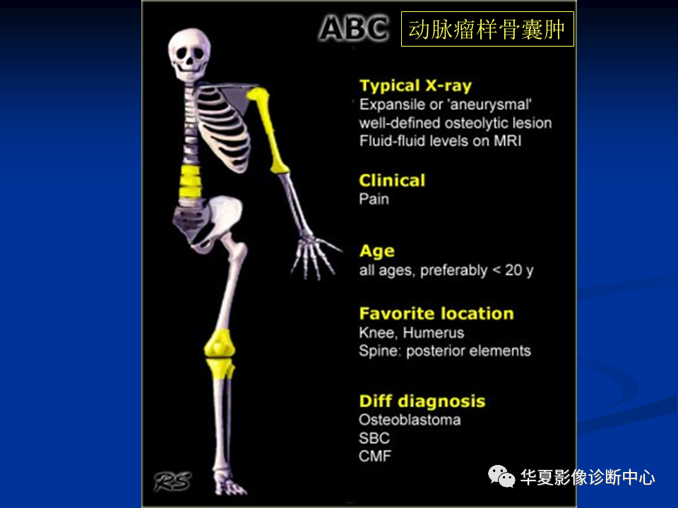 影像PPT - 【PPT】骨肿瘤影像诊断思路-134