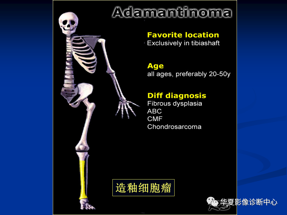 影像PPT - 【PPT】骨肿瘤影像诊断思路-137
