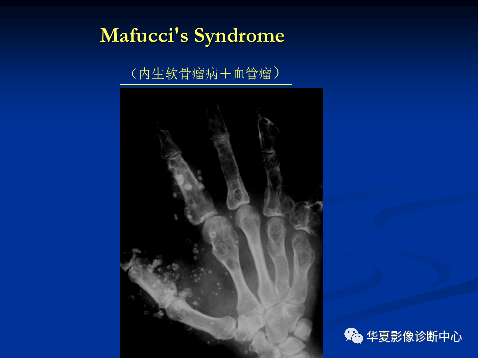 影像PPT - 【PPT】骨肿瘤影像诊断思路-152