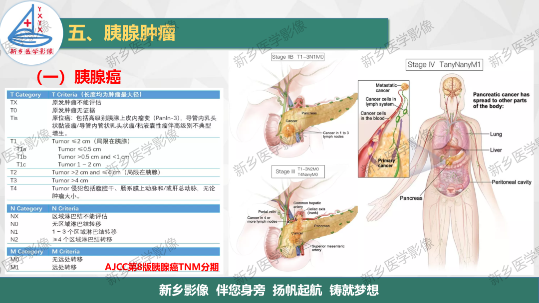 影像PPT - 【PPT】胰腺疾病影像表现-15