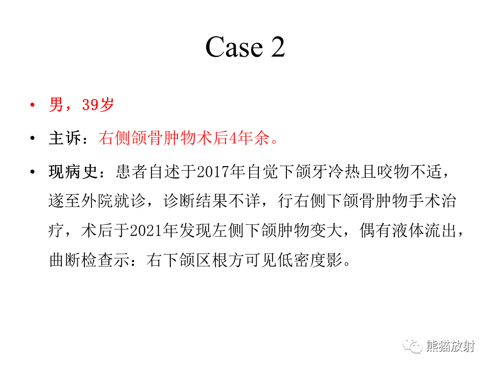 影像PPT - 【病例】颌骨成釉细胞瘤2例CT影像-9