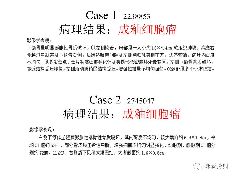 影像PPT - 【病例】颌骨成釉细胞瘤2例CT影像-16