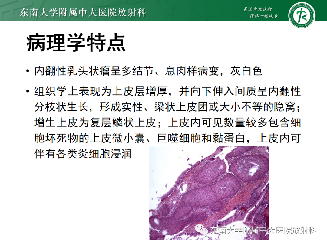 影像PPT - 【PPT】鼻内翻性乳头状瘤-8 影像PPT - 【PPT】鼻内翻性乳头状瘤-8