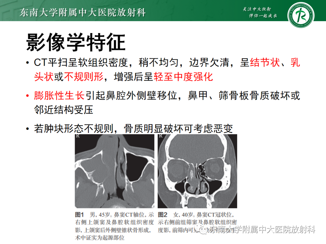 影像PPT - 【PPT】鼻内翻性乳头状瘤-10 影像PPT - 【PPT】鼻内翻性乳头状瘤-10