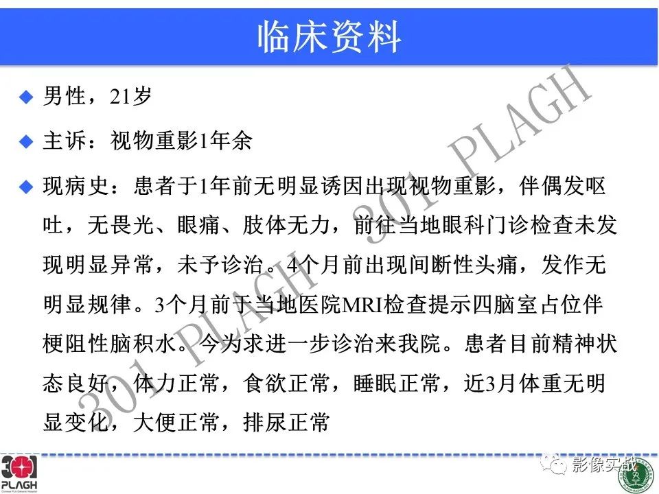 影像PPT - 【病例】四脑室非典型脉络丛乳头状瘤1例CT及MR-2