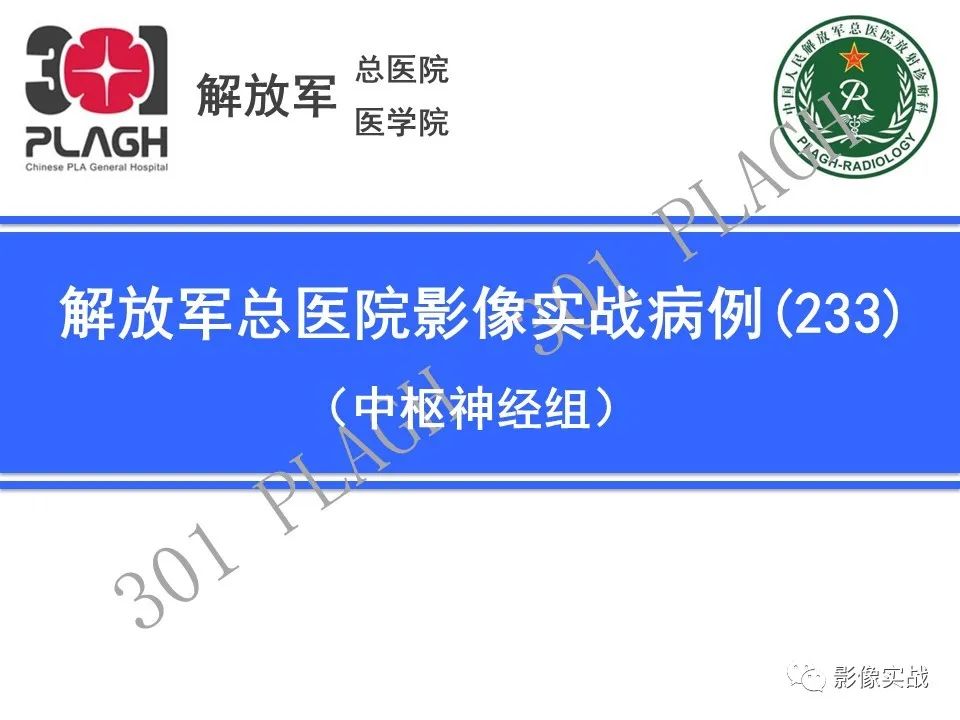 影像PPT - 【病例】四脑室非典型脉络丛乳头状瘤1例CT及MR-1