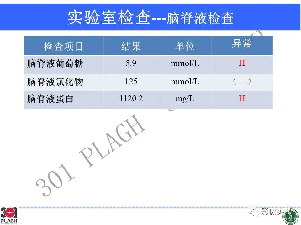 影像PPT - 【病例】四脑室非典型脉络丛乳头状瘤1例CT及MR-5
