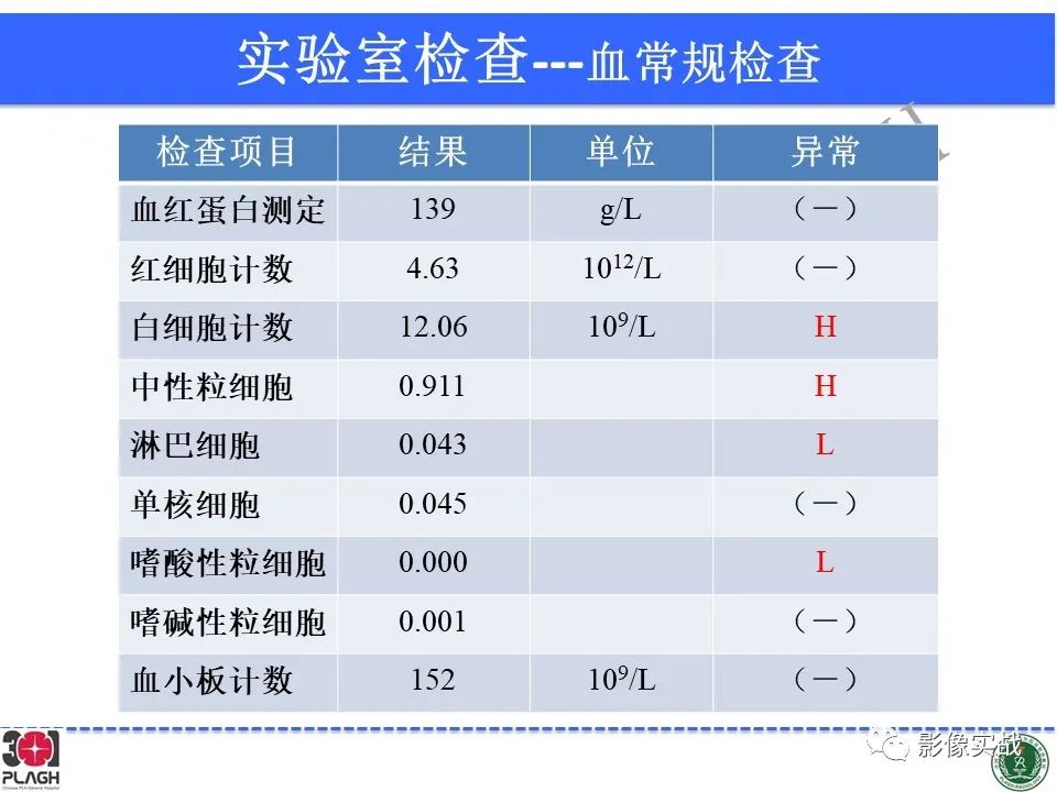 影像PPT - 【病例】四脑室非典型脉络丛乳头状瘤1例CT及MR-4