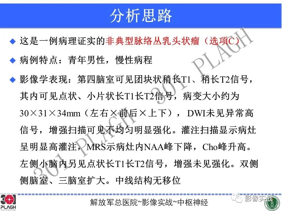 影像PPT - 【病例】四脑室非典型脉络丛乳头状瘤1例CT及MR-20