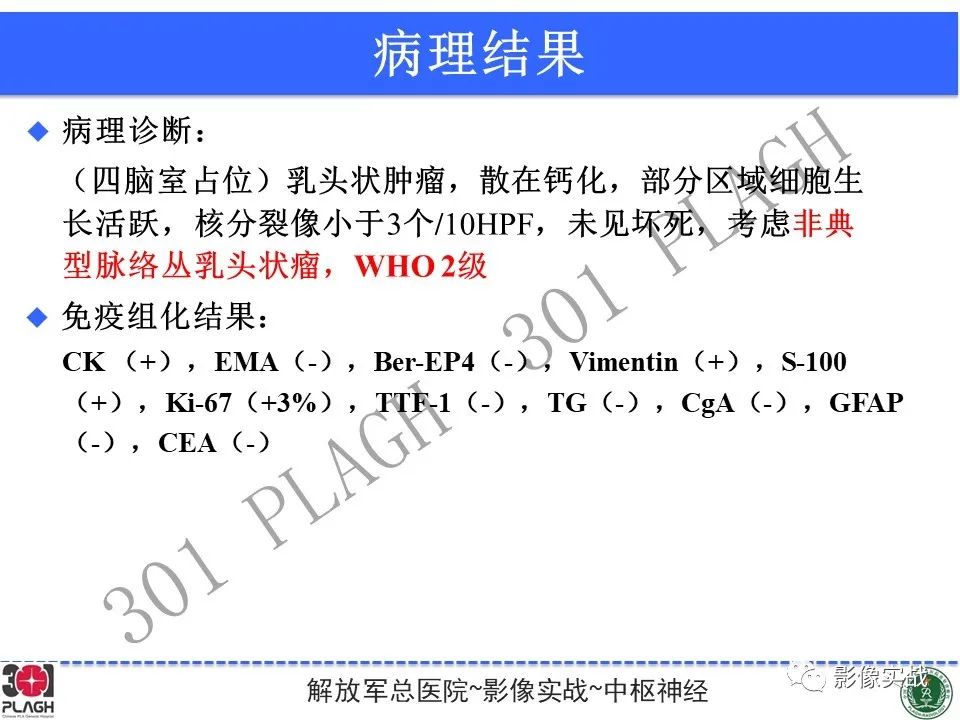 影像PPT - 【病例】四脑室非典型脉络丛乳头状瘤1例CT及MR-27