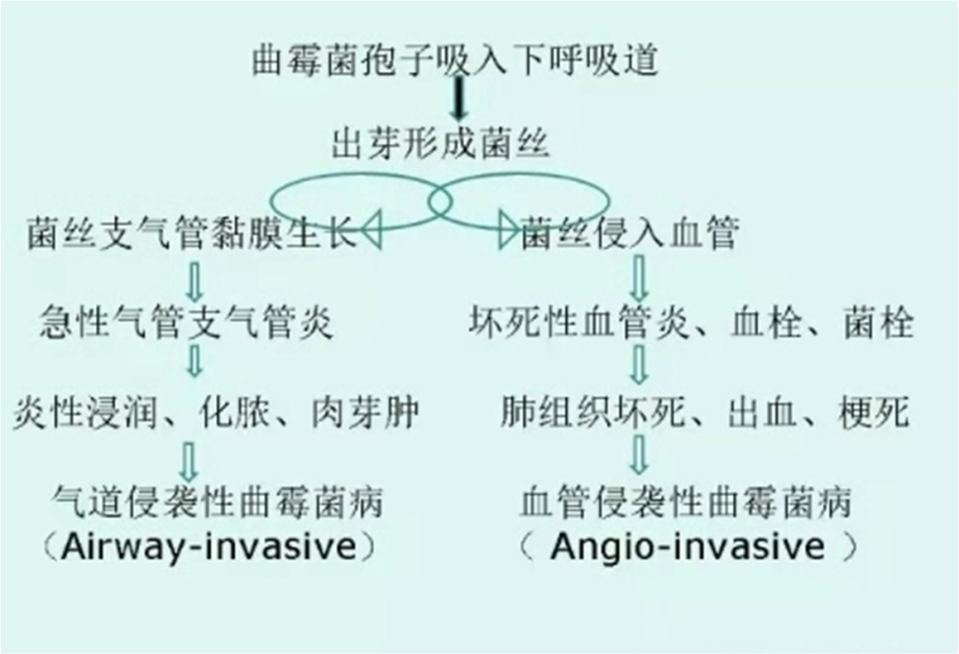 影像PPT - 肺曲菌病分型及 CT 表现-8 影像PPT - 肺曲菌病分型及 CT 表现-8