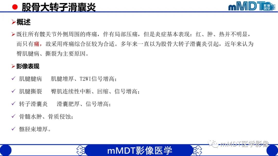 影像PPT - 【PPT】髋关节疼痛影像与临床(二)-13 影像PPT - 【PPT】髋关节疼痛影像与临床(二)-13