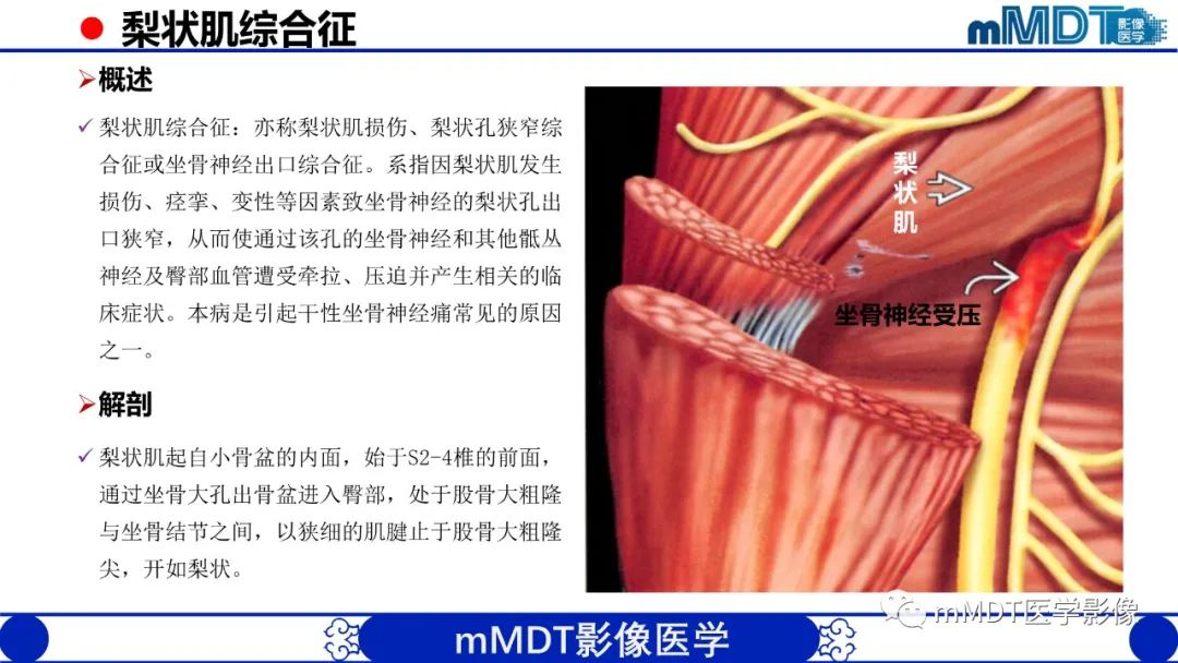 影像PPT - 【PPT】髋关节疼痛影像与临床(二)-15 影像PPT - 【PPT】髋关节疼痛影像与临床(二)-15