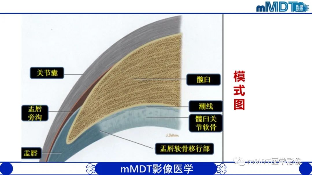 影像PPT - 【PPT】髋关节疼痛影像与临床(二)-20 影像PPT - 【PPT】髋关节疼痛影像与临床(二)-20