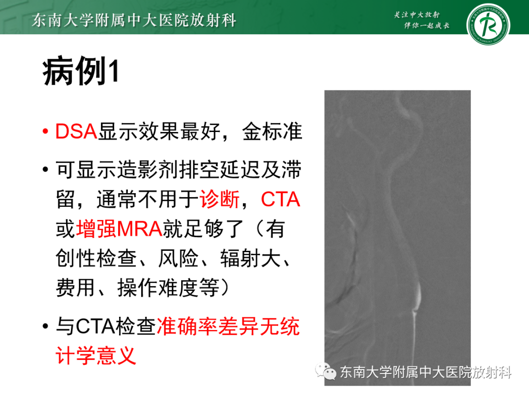 影像PPT - 【PPT】颈动脉蹼-3