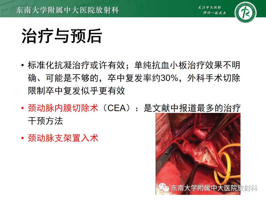 影像PPT - 【PPT】颈动脉蹼-25