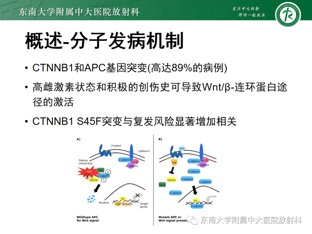 影像PPT - 【PPT】腹壁韧带样纤维瘤病-9