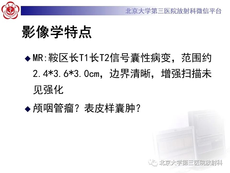 影像PPT - 【PPT】鞍区、鞍旁肿瘤-5