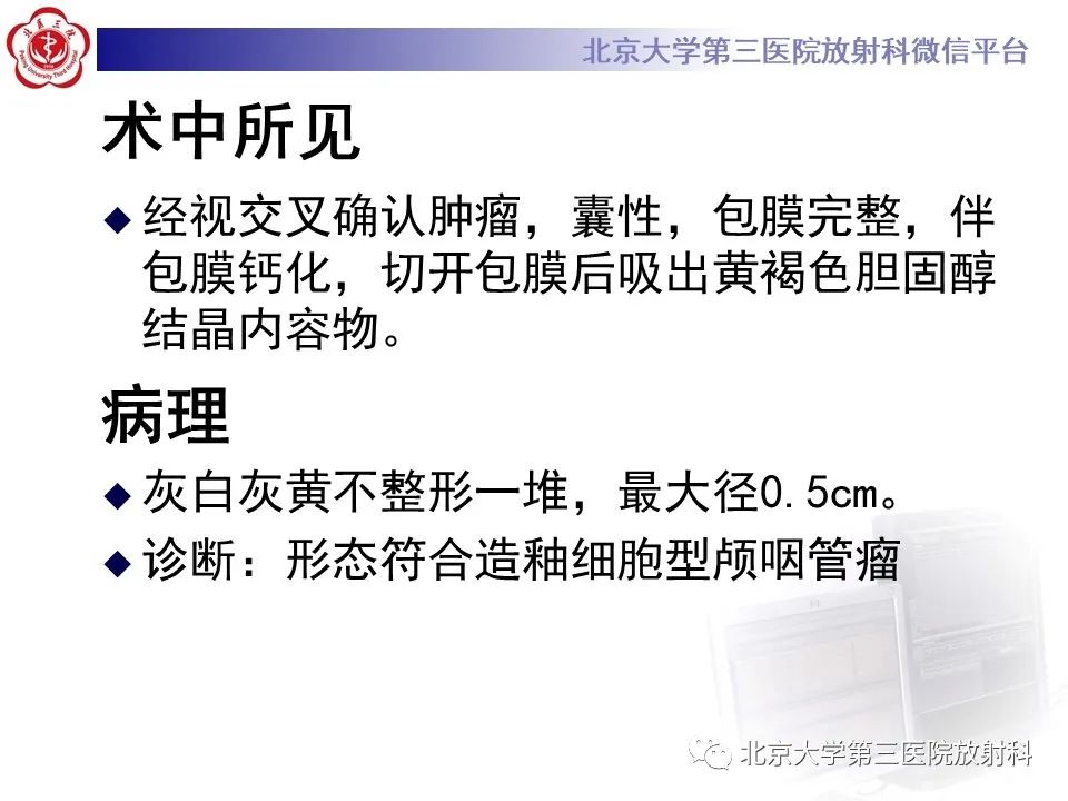 影像PPT - 【PPT】鞍区、鞍旁肿瘤-6