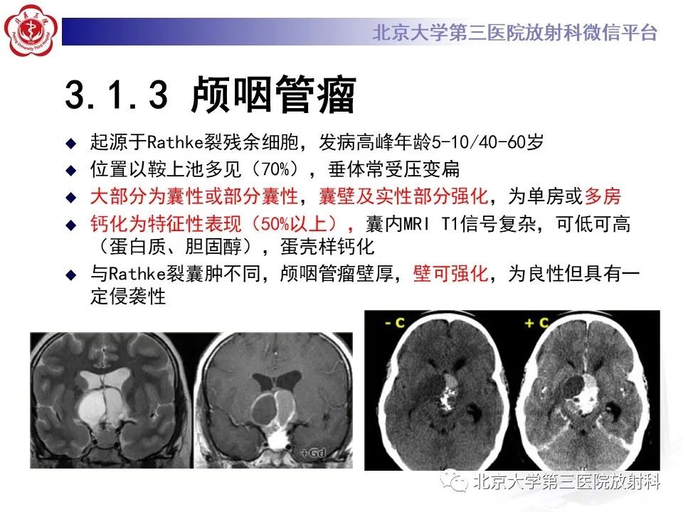 影像PPT - 【PPT】鞍区、鞍旁肿瘤-17