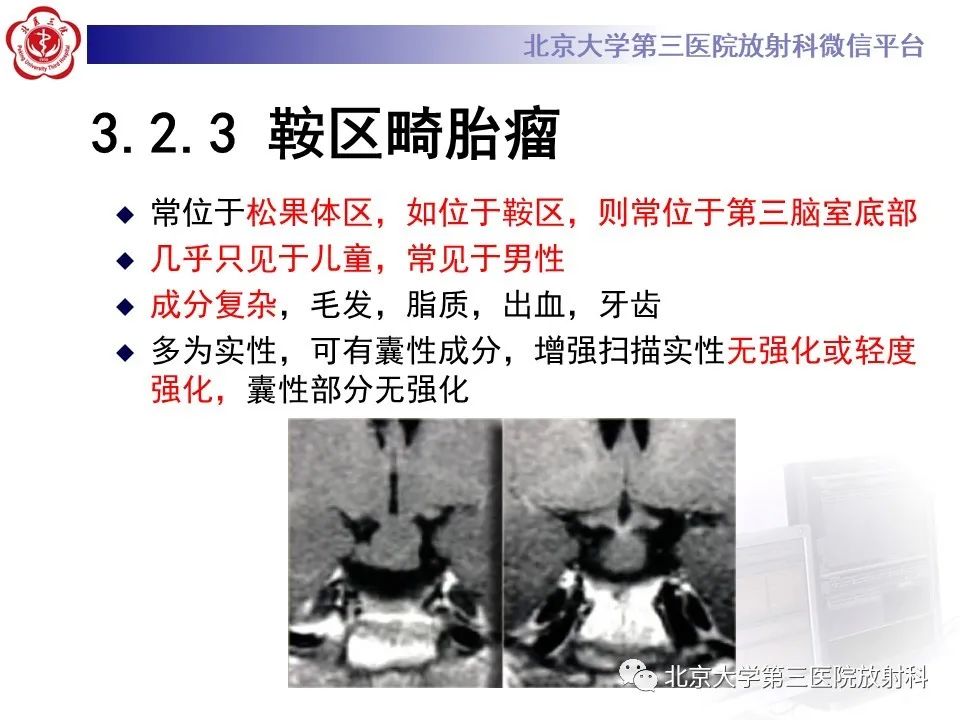 影像PPT - 【PPT】鞍区、鞍旁肿瘤-27