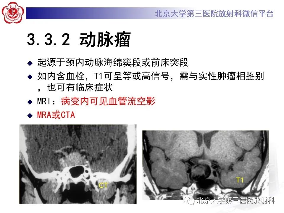 影像PPT - 【PPT】鞍区、鞍旁肿瘤-32