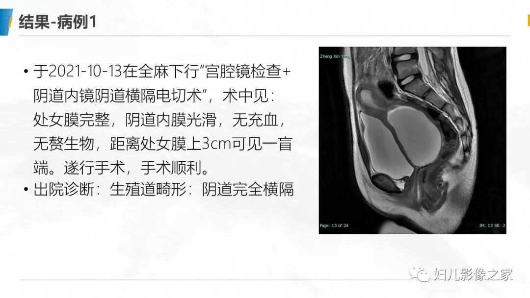 影像PPT - 【PPT】阴道积血3例诊断及鉴别诊断-11