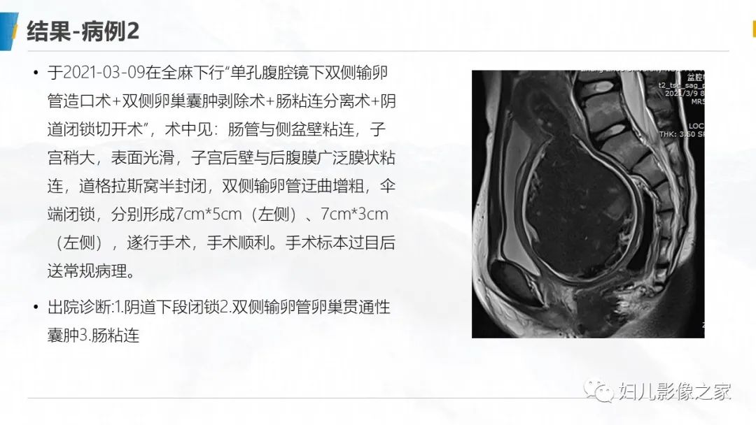 影像PPT - 【PPT】阴道积血3例诊断及鉴别诊断-12