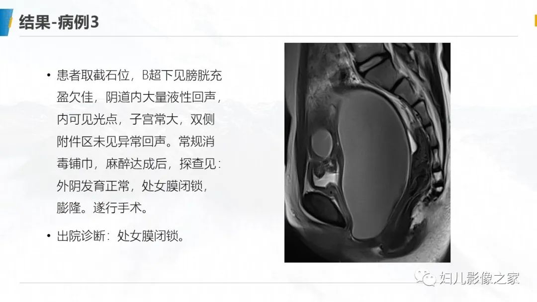 影像PPT - 【PPT】阴道积血3例诊断及鉴别诊断-13